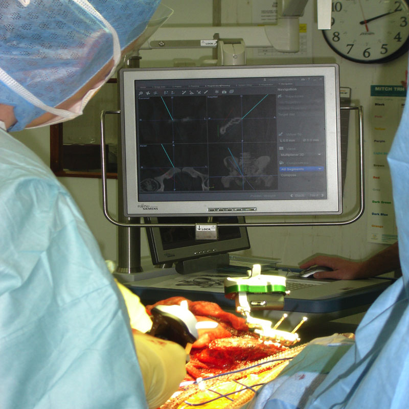 Fig 11. Navigation in use